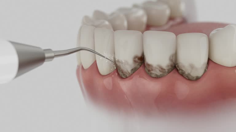 Trusted Dental Implants service in Olathe, KS - Dentist Open Now